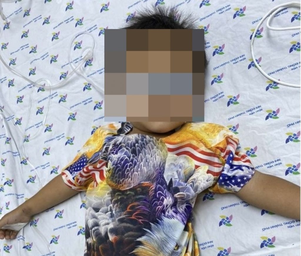 Bé trai 30 tháng tuổi nguy kịch do uống nhầm nước tẩy mực in