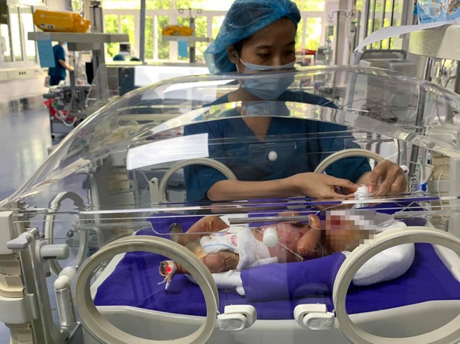 Bé trai mắc bệnh da vảy cá được điều trị thế nào?