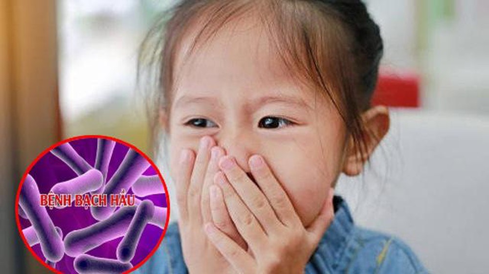 Bệnh bạch hầu diễn biến phức tạp tại miền Trung và Tây Nguyên cần được dập tắt