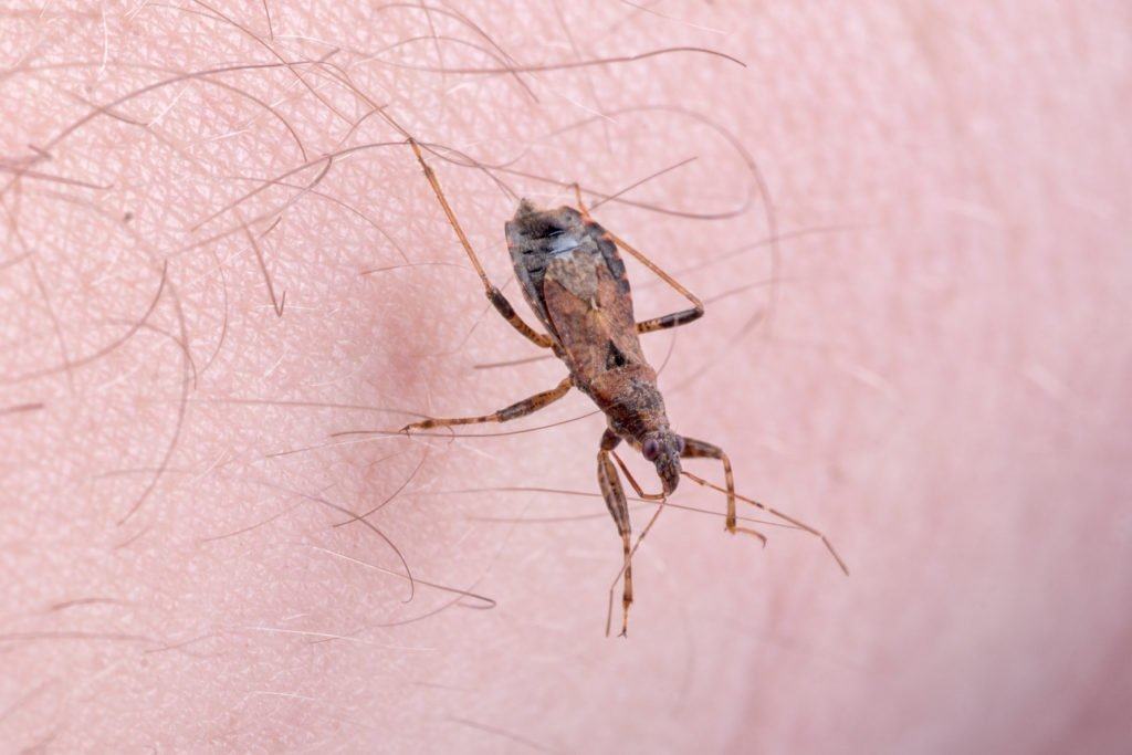 Bệnh Chagas là gì? Nguyên nhân và triệu chứng bạn cần biết