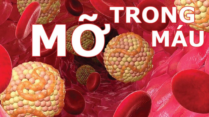 Bệnh mỡ máu có nguy hiểm không? Người mắc bệnh mỡ máu nên ăn gì?