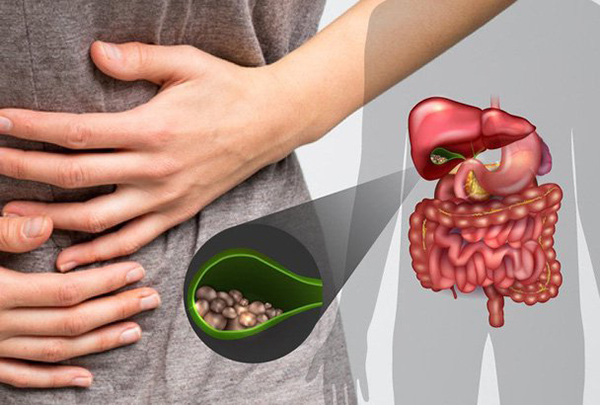 Bệnh sỏi mật có nguy hiểm không? Cách điều trị bệnh như thế nào?