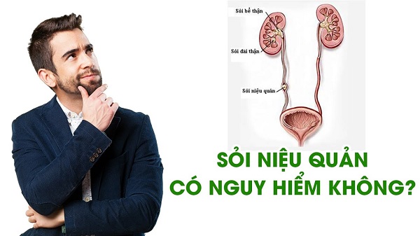 Bệnh sỏi niệu quản có nguy hiểm không? Phương pháp điều trị bệnh như thế nào?