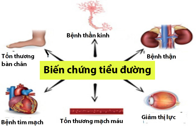 benh-tieu-duong-co-chua-duoc-khong
