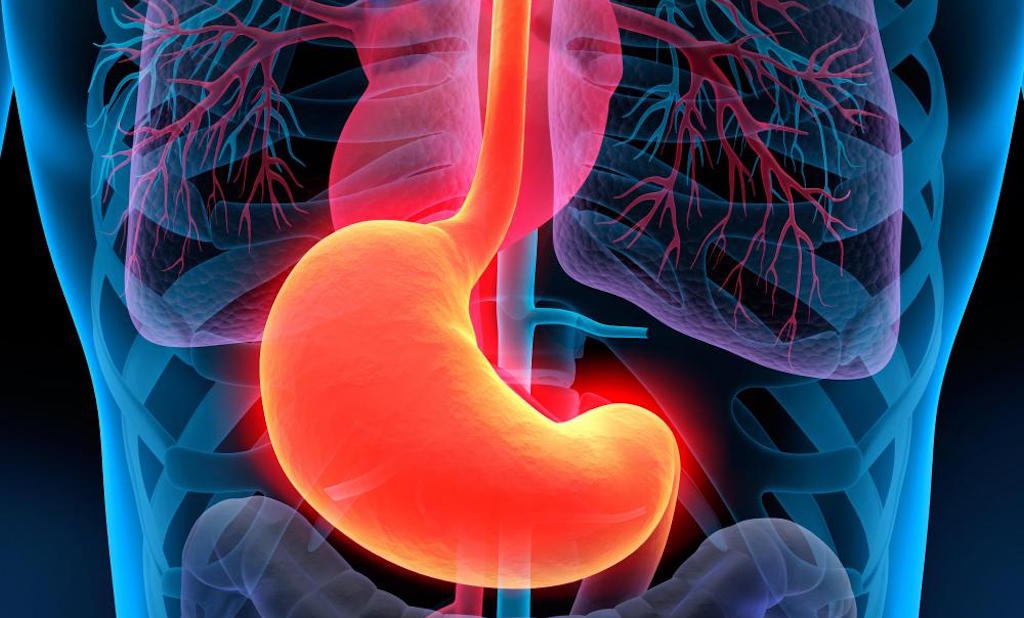 benh-viem-loet-hanh-ta-trang