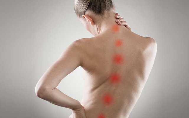 Các phương pháp điều trị bệnh Cong vẹo cột sống mà bạn cần biết