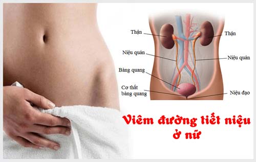 Các triệu chứng nhận biết sớm tình trạng viêm đường tiết niệu ở nữ giới