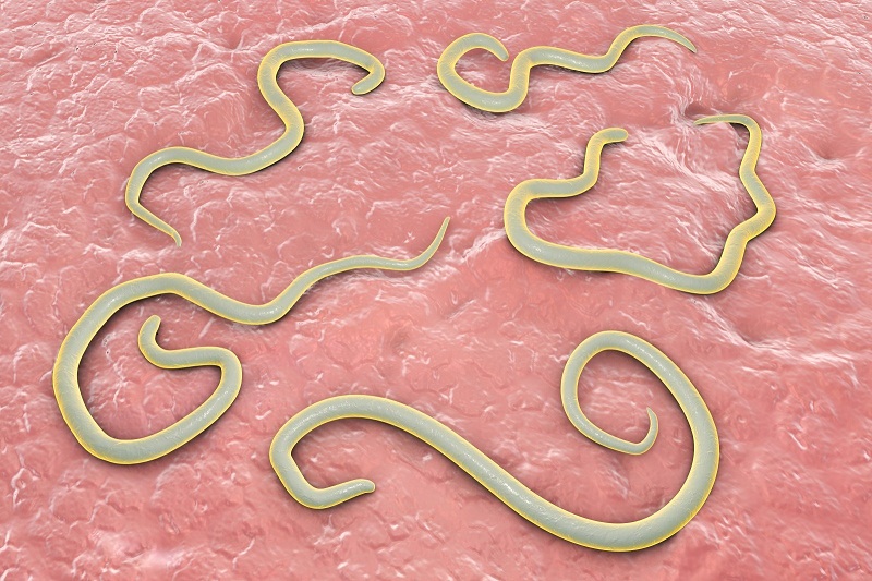 Cách nhận biết bệnh giun kim và phòng ngừa hiệu quả