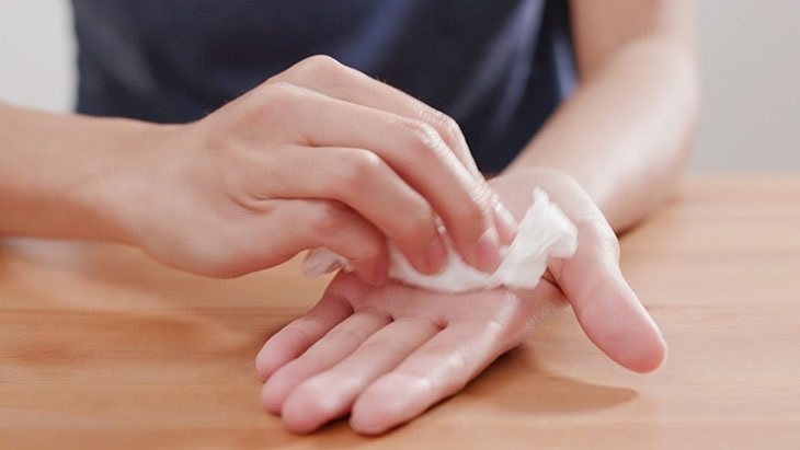 Chia sẻ cách chữa trị hiệu quả bệnh mồ hôi tay chân