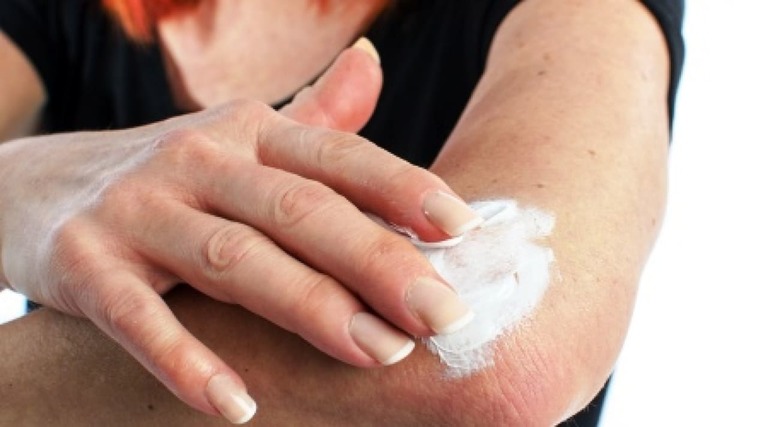 dau-hieu-benh-vay-nen