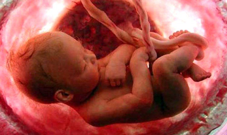 Dấu hiệu nhận biết nhiễm trùng ối mẹ bầu cần biết