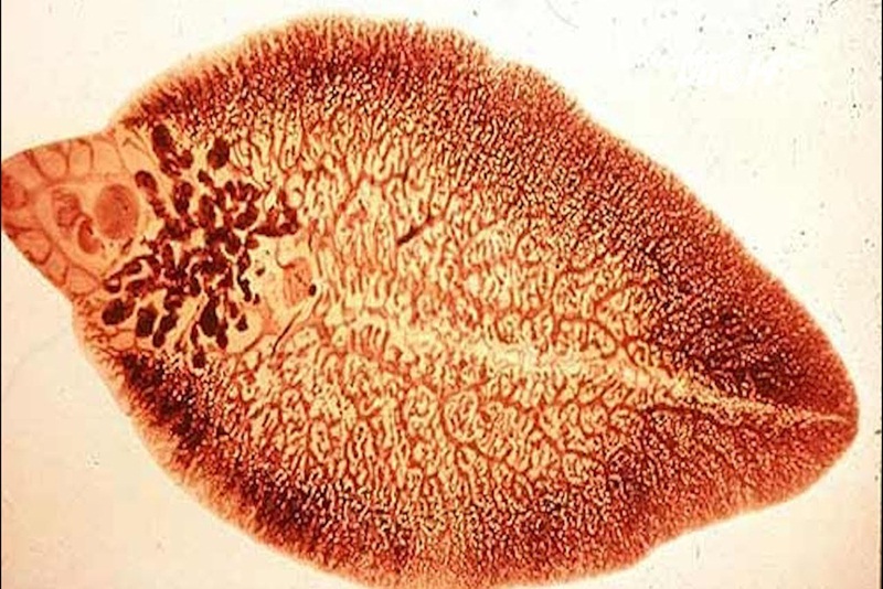 Dấu hiệu nhận biết và phương pháp điều trị bệnh sán lá gan