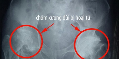 hoai-tu-chom-xuong-dui