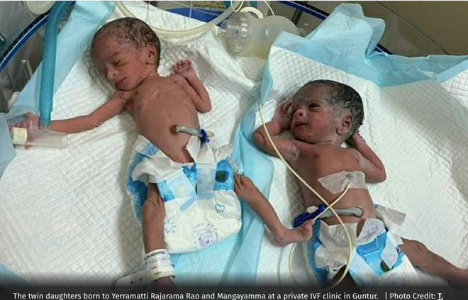 Hy hữu, sản phụ 73 tuổi sinh đôi 2 bé gái khỏe mạnh