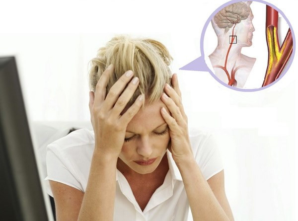 Đau đầu c&oacute; thể l&agrave; một trong những dấu hiệu của bệnh chấn động n&atilde;o