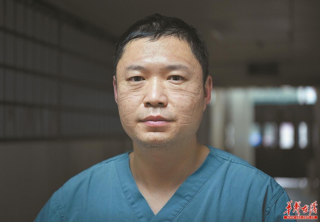 Loạt ảnh chụp khu&ocirc;n mặt với đầy những vết l&otilde;m, vết lo&eacute;t