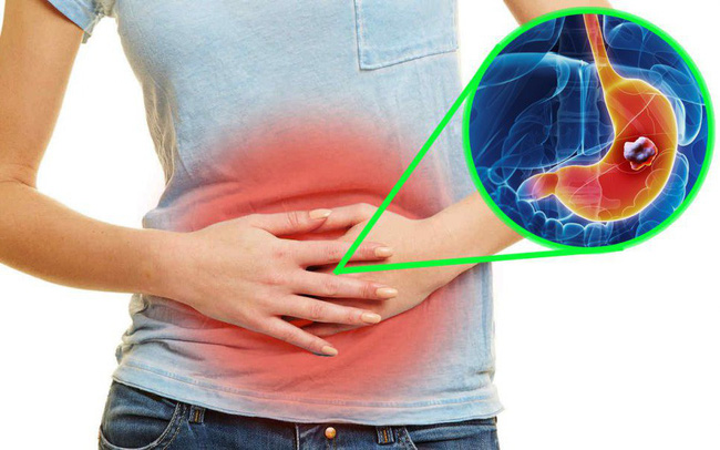  Thuốc Ambroxol c&oacute; thể ảnh hưởng nhẹ đến hệ ti&ecirc;u h&oacute;a