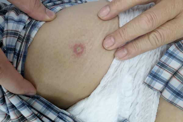 phu-nu-bi-con-trung-dot