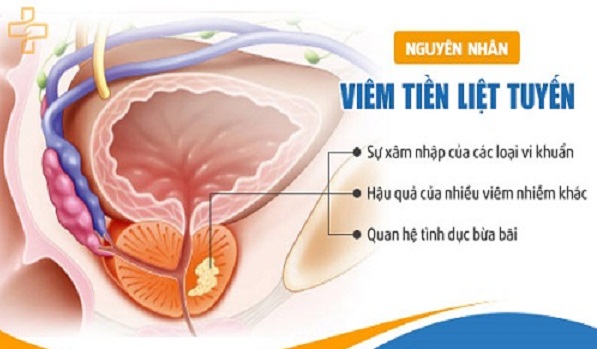 Tuy&ecirc;́n ti&ecirc;̀n li&ecirc;̣t là gì?