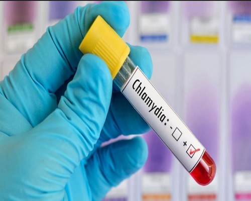 Khi phát hiện bị bệnh Chlamydia cần đến viện điều trị ngay