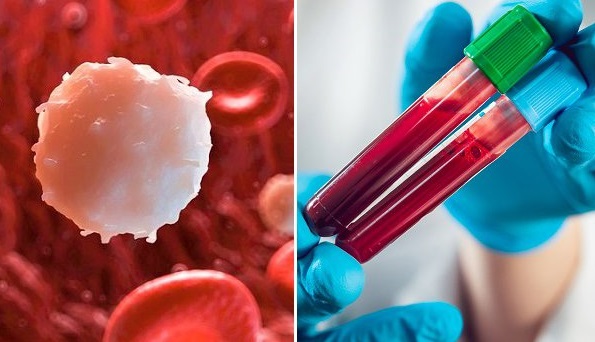 Nguy&ecirc;n nh&acirc;n mắc bệnh bạch cầu kh&aacute; đa dạng