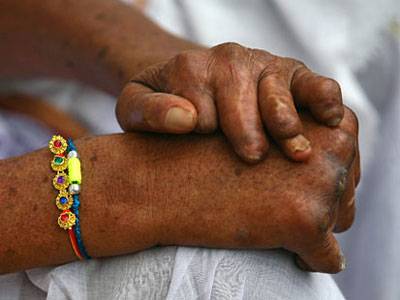 Nguyên nhân và dấu hiệu nhận biết của bệnh phong