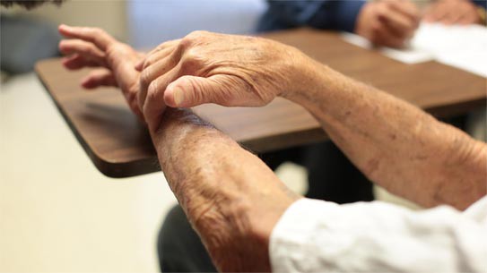 Những dấu hiệu để nhận biết bệnh phong