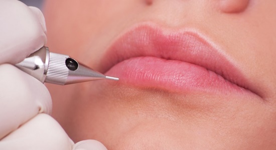 Nhập viện điều trị vì môi sưng vù sau khi xăm môi đón Tết