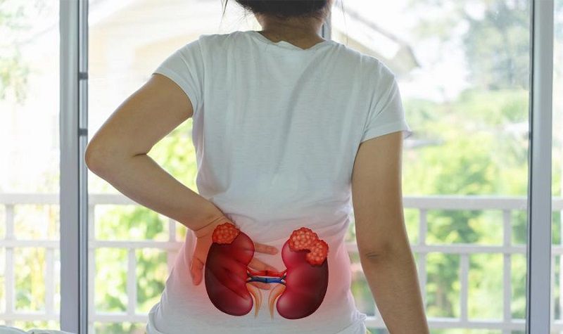 Những dấu hiệu nhận biết của bệnh áp xe thận là gì?