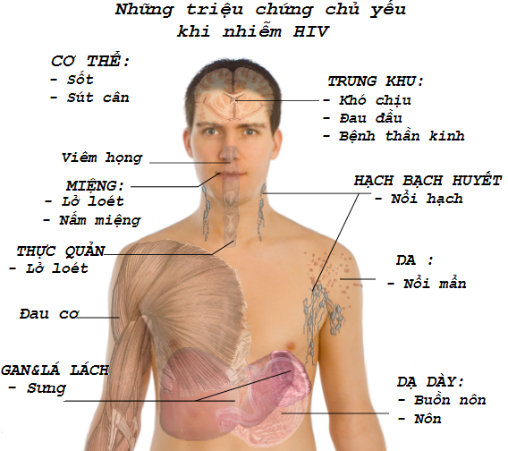 những dấu hiệu của nhiễm HIV