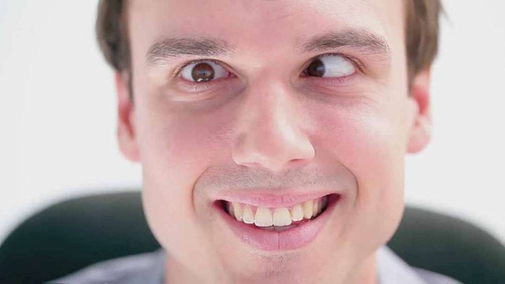 Những dấu hiệu và triệu chứng của liệt dây thần kinh số 6 là gì?