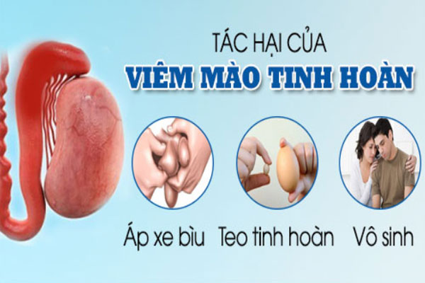 Những điều bạn cần biết về bệnh Viêm mào tinh hoàn