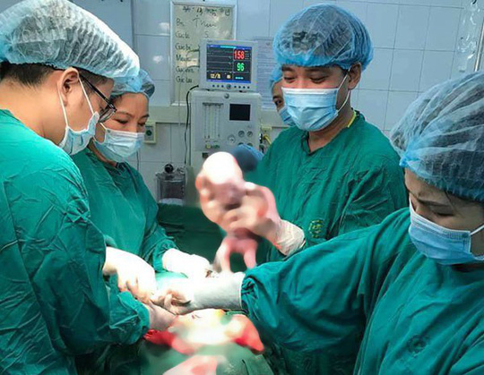 Sản phụ sinh ba bé trai cùng trứng hiếm gặp, 200 triệu ca mới có một