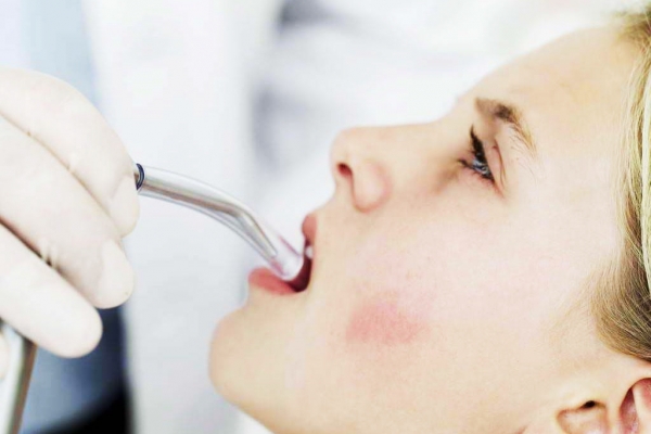 sỏi tuyến nước bọt