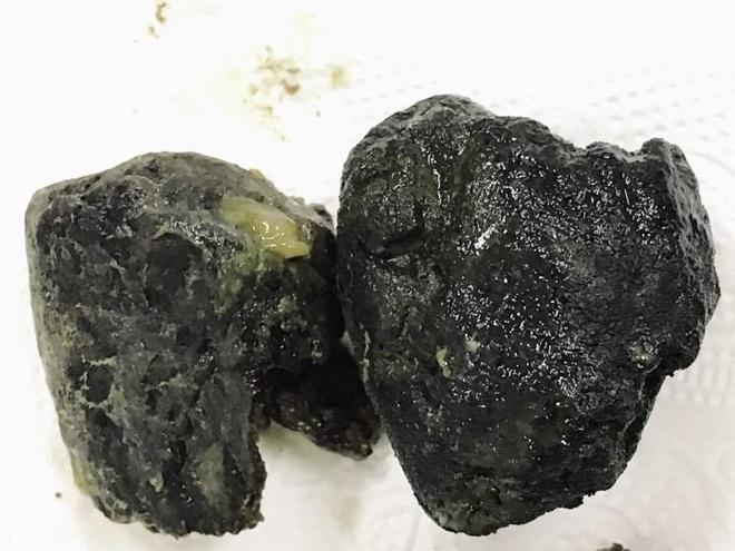 tai-nam-uong-tra-sua