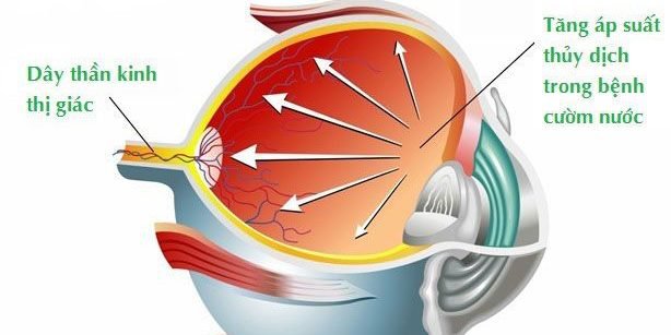 tăng nh&atilde;n &aacute;p