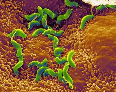 Thuốc Cefixime 200 c&oacute; t&aacute;c dụng điều trị một số bệnh nhiễm tr&ugrave;ng do vi khuẩn