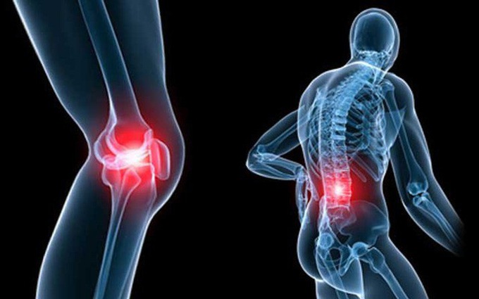 Tìm hiểu phương pháp điều trị bệnh đa u tủy xương