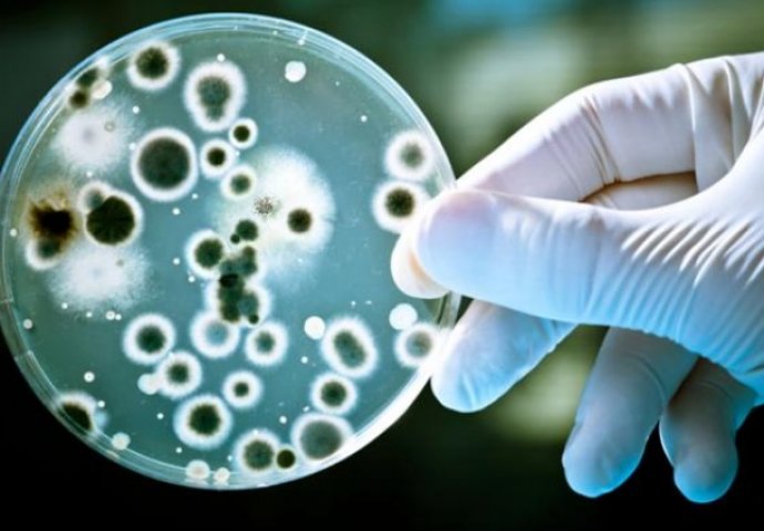 Tìm hiểu Xét nghiệm vi sinh là gì?