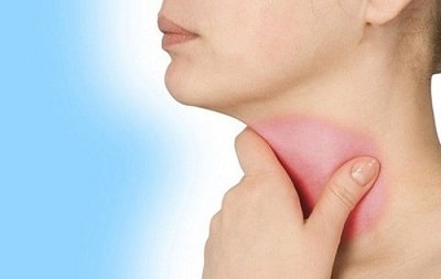 Tìm nguyên nhân gây ra giãn tĩnh mạch thực quản