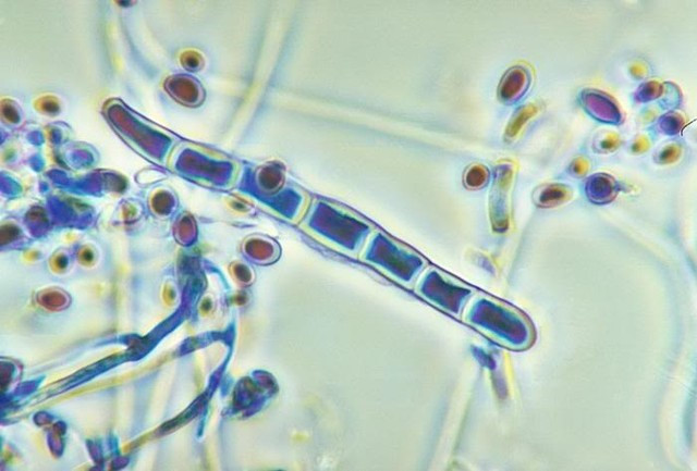 Nấm trichophyton g&acirc;y bệnh hắc l&agrave;o