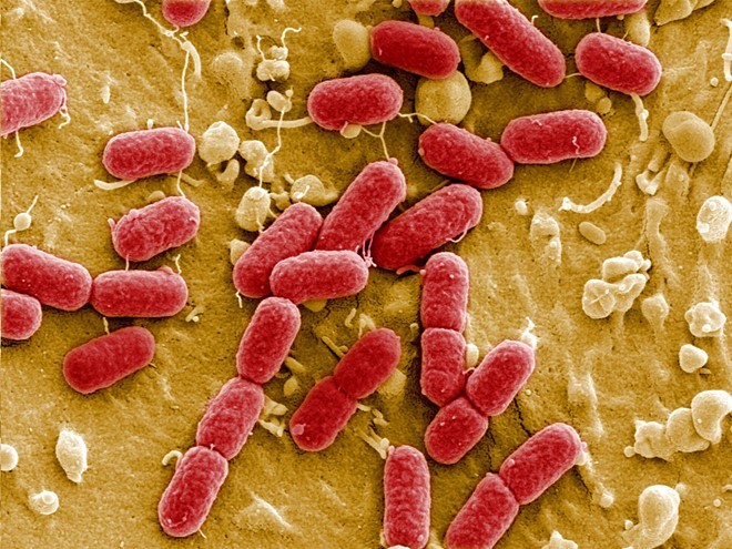 Vi khuẩn E.coli hiện nay đ&atilde; kh&aacute;ng kh&aacute;ng sinh Carbapenem l&agrave; loại kh&aacute;ng sinh được coi l&agrave; vũ kh&iacute; cuối c&ugrave;ng để điều trị 