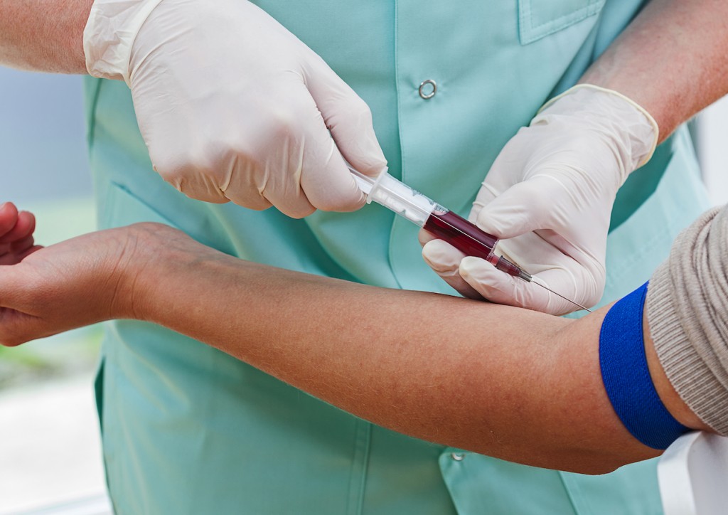 Công thức máu là xét nghiệm quan trọng